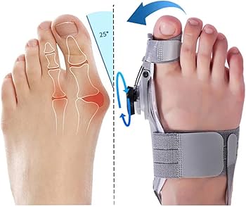 👣 Camina sin dolor: el corrector de juanetes que realmente funciona 👟 Diseñado para tus pies, pensado para tu salud! #Envio Gratis a toda Guatemala#