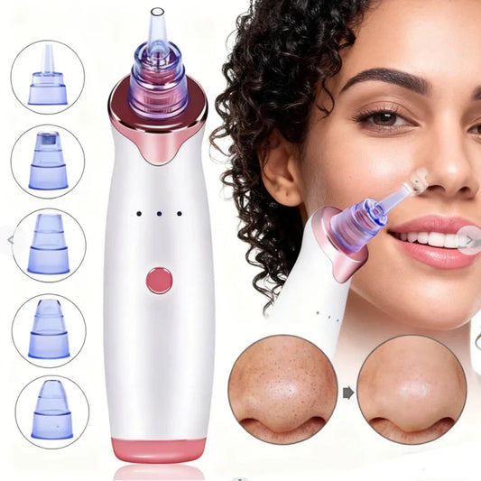 🧼 Extractor de Poros y Espinillas + 5 boquillas GRATIS 🎁